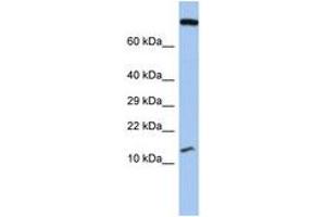 Image no. 1 for anti-Chromosome 5 Open Reading Frame 64 (C5ORF64) (AA 71-120) antibody (ABIN6743861) (C5ORF64 Antikörper  (AA 71-120))
