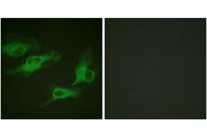Immunofluorescence analysis of HeLa cells, using Adrenergic Receptor beta2 (Phospho-Ser346) Antibody. (beta 2 Adrenergic Receptor Antikörper  (pSer346))