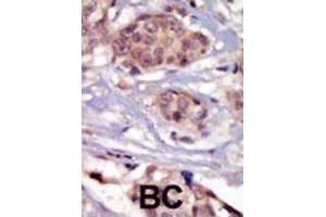 Immunohistochemistry (IHC) image for anti-FYN Oncogene Related To SRC, FGR, YES (FYN) antibody (ABIN3003445) (FYN Antikörper)