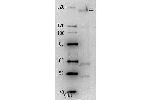 Western Blotting (WB) image for anti-SARS-Coronavirus Spike Protein (SARS-CoV S) antibody (ABIN2452119) (SARS-CoV Spike Antikörper)