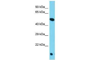 Host: Rabbit Target Name: TOR4A Sample Type: HepG2 Whole Cell lysates Antibody Dilution: 1. (TOR4A Antikörper  (C-Term))