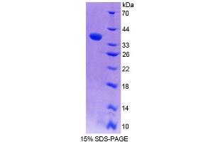 SDS-PAGE analysis of Mouse EPB41 Protein.