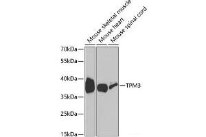 Western blot analysis of extracts of various cell lines using TPM3 Polyclonal Antibody at dilution of 1:1000. (TPM3 Antikörper)
