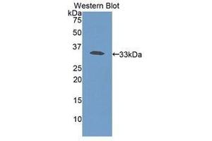 Western Blotting (WB) image for anti-Haptoglobin (HP) (AA 70-332) antibody (ABIN3207779) (Haptoglobin Antikörper  (AA 70-332))