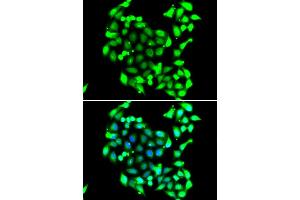 Immunofluorescence analysis of A549 cells using GTF2H3 antibody. (GTF2H3 Antikörper)