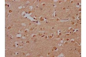 IHC image of ABIN7166499 diluted at 1:200 and staining in paraffin-embedded human brain tissue performed on a Leica BondTM system. (Src Antikörper  (AA 2-100))