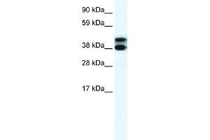 WB Suggested Anti-RFP2 Antibody Titration:  0. (TRIM13 Antikörper  (Middle Region))