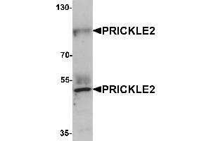 Western blot analysis of PRICKLE2 in A-20 lysate with PRICKLE2 antibody at 1 µg/mL. (PRICKLE2 Antikörper  (Middle Region))