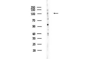 anti-FAST Kinase Domains 1 (FASTKD1) (Internal Region) antibody