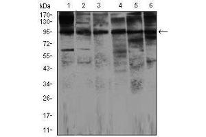 Western Blotting (WB) image for anti-Nitric Oxide Synthase 2, Inducible (NOS2) antibody (ABIN1108478)