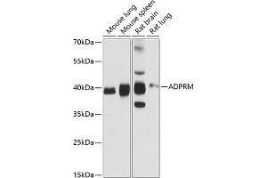 Western blot analysis of extracts of various cell lines, using ADPRM antibody (ABIN6131440, ABIN6136589, ABIN6136590 and ABIN6216678) at 1:3000 dilution.