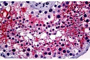 Anti-ACE-2 antibody IHC staining of human testis. (ACE2 Antikörper  (Internal Region))