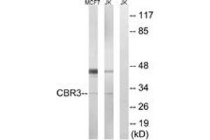 Western Blotting (WB) image for anti-Carbonyl Reductase 3 (CBR3) (AA 151-200) antibody (ABIN2890192) (CBR3 Antikörper  (AA 151-200))