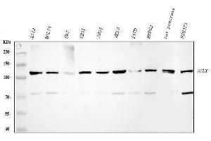 Western blot analysis of ACLY using anti-ACLY antibody (ABIN4886416). (ACLY Antikörper  (AA 1-180))