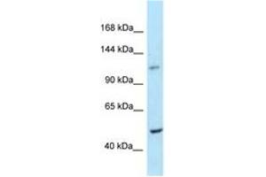 Image no. 1 for anti-diphosphoinositol Pentakisphosphate Kinase 2 (PPIP5K2) (AA 914-963) antibody (ABIN6748048) (HISPPD1 Antikörper  (AA 914-963))