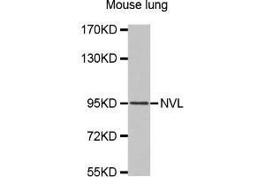 Western Blotting (WB) image for anti-Nuclear VCP-Like (NVL) antibody (ABIN1875763) (NVL Antikörper)