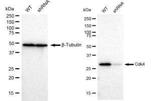 Western blotting analysis using Cdk4 antibody (ABIN7798213). (Rekombinanter CDK4 Antikörper)