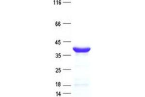 Western Blotting (WB) image for Potassium Channel Tetramerisation Domain Containing 7 (KCTD7) protein (His tag) (ABIN2724083)