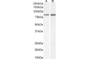 (ABIN7505831) (2 μg/mL) staining of A549 (A) and Caco-2 (B) cell lysate (35 μg protein in RIPA buffer). (Phospholipase C delta 3 Antikörper  (AA 261-274))