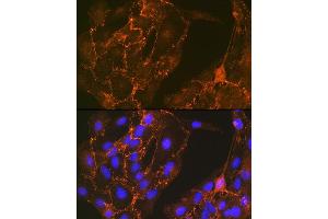 Immunofluorescence (IF) image for anti-Cortactin (CTTN) antibody (ABIN7266511)