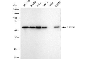 Western blotting analysis using CDC25B antibody (ABIN7798005).