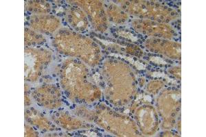 Used in DAB staining on fromalin fixed paraffin- embedded kidney tissue (Myosin IA Antikörper  (AA 781-1043))
