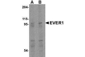 Western blot analysis of EVER1 in human spleen tissue lysate with AP30322PU-N EVER1 antibody at (A) 1 and (B) 2 μg/ml.