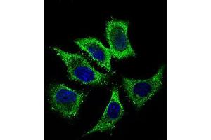 Immunofluorescence analysis of HepG2 cells using ALDH2 mouse mAb (green). (ALDH2 Antikörper  (AA 317-517))