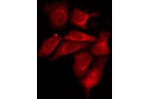ABIN6275929 staining 293T by IF/ICC. (S1PR1 Antikörper  (Internal Region))