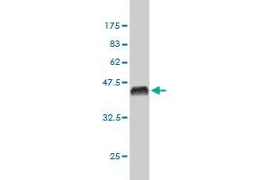 Western Blot detection against Immunogen (36. (Exportin 2 Antikörper  (AA 872-971))
