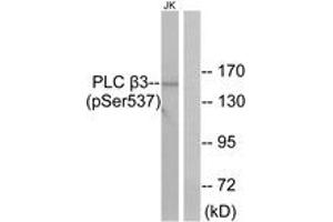 Western blot analysis of extracts from Jurkat cells treated with UV 15', using PLC beta3 (Phospho-Ser537) Antibody. (PLCB3 Antikörper  (pSer537))
