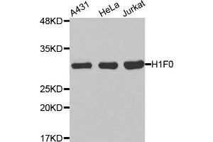 Western Blotting (WB) image for anti-H1 Histone Family, Member 0 (H1F0) antibody (ABIN1872929)