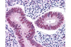 Immunohistochemistry (IHC) image for anti-Signal Transducer and Activator of Transcription 3 (Acute-Phase Response Factor) (STAT3) (Middle Region) antibody (ABIN504617) (STAT3 Antikörper  (Middle Region))