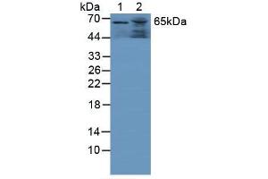 Figure. (GAA Antikörper  (AA 595-770))