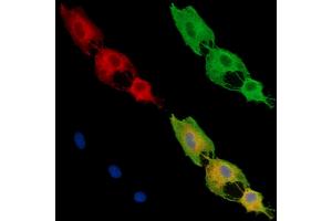 ABIN7096031 and ABIN7100093 staining  cells by IF/ICC. (DENND1A Antikörper)