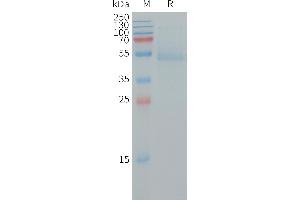 SDS-PAGE (SDS) image for Ras Homolog Gene Family, Member B (RHOB) (AA 1-188) protein (Fc Tag) (ABIN7491409)