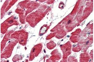 Human Heart (formalin-fixed, paraffin-embedded) stained with Heat Shock Protein 27 (HSP27) antibody ABIN462101 at 10 ug/ml followed by biotinylated goat anti-rabbit IgG secondary antibody ABIN481713, alkaline phosphatase-streptavidin and chromogen. (HSP27 Antikörper)