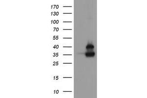 Image no. 1 for anti-OTU Domain, Ubiquitin Aldehyde Binding 1 (OTUB1) antibody (ABIN1499929) (OTUB1 Antikörper)