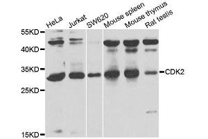 Western blot analysis of extracts of various cell lines, using CDK2 antibody. (CDK2 Antikörper)