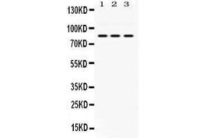 Western blot analysis of KRIT1 expression in rat cardiac muscle extract ( Lane 1), NIH3T3 whole cell lysates ( Lane 2) and HELA whole cell lysates ( Lane 3).
