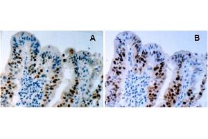 Immunohistochemistry (IHC) image for anti-Tumor Protein P53 (TP53) (AA 378-393), (pSer392) antibody (ABIN487475) (p53 Antikörper  (pSer392))