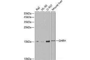 Western blot analysis of extracts of various cell lines using GHRH Polyclonal Antibody at dilution of 1:1000. (GHRH Antikörper)