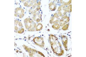 Immunohistochemistry of paraffin-embedded human stomach using PER1 antibody (ABIN5974860) at dilution of 1/100 (40x lens). (PER1 Antikörper)