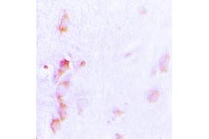 Immunohistochemical analysis of CDCA3 staining in human brain formalin fixed paraffin embedded tissue section. (CDCA3 Antikörper  (C-Term))