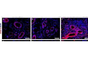 Increased expression of lymphangiogenic mediators in minor salivary glands (MSGs) from patients with primary Sjögren's syndrome (pSS). (VEGFC Antikörper  (AA 321-415))