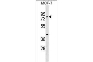 Western blot analysis in MCF-7 cell line lysates (35ug/lane). (TOX4 Antikörper  (N-Term))