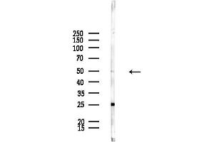 anti-Eyes Absent Homolog 2 (Drosophila) (EYA2) (Internal Region) antibody
