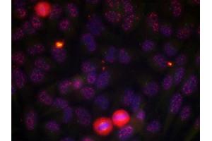 Immunofluorescence staining of methanol-fixed HeLa cells using Elk-1 (phospho-Thr417) antibody. (ELK1 Antikörper  (pThr417))