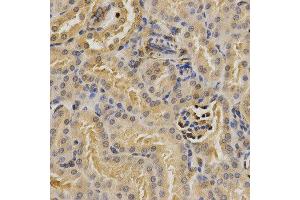 Immunohistochemistry (IHC) image for anti-Proteasome (Prosome, Macropain) 26S Subunit, Non-ATPase, 9 (PSMD9) antibody (ABIN1876545) (PSMD9 Antikörper)