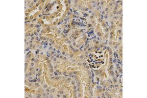 Immunohistochemistry (IHC) image for anti-Proteasome (Prosome, Macropain) 26S Subunit, Non-ATPase, 9 (PSMD9) antibody (ABIN1876545) (PSMD9 Antikörper)